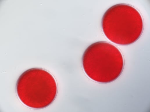 Haematococcus pluvialis red aplanospores FPC42 AXA3 202503271445 100x DIC250328171841