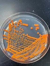 Phaffia_rhodozyma_on_PDA